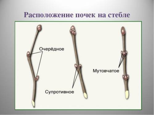 Какие виды почек бывают по расположению?