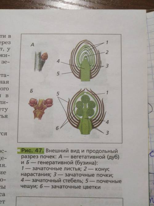 Напишите названия частей почек,изображённых на рисунках.назовите и сравните их. !