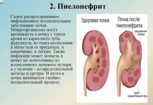 определи верно ли утверждение 4. Бактерии, вызывающие инфекции в организме человека, такие как забол