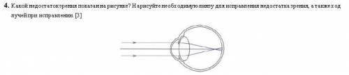 Какой недостатокзрения показанна рисунке? Нарисуйте необходимую линзу для исправления недостатка зре