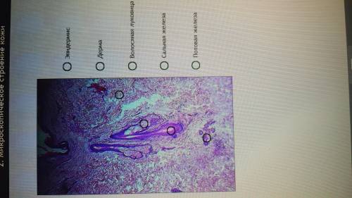 Биология. Укажите на микропрепарате кожи основные элементы ее структуры.