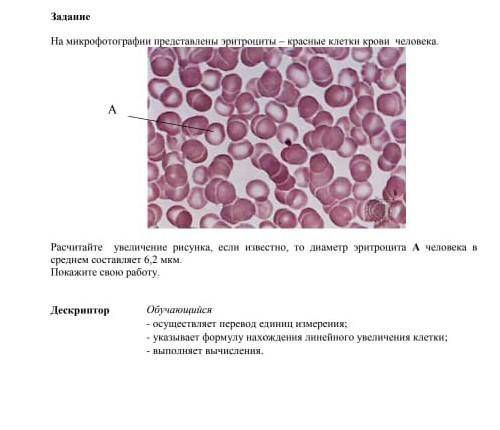 расчитайте увеличение рисунка если известно что диаметр эритроцита А человеке в среднем состовляет 6