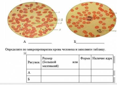 по биологии СОР, Криминалисту необходимо выяснить, какой из образцов крови принадлежит человеку.