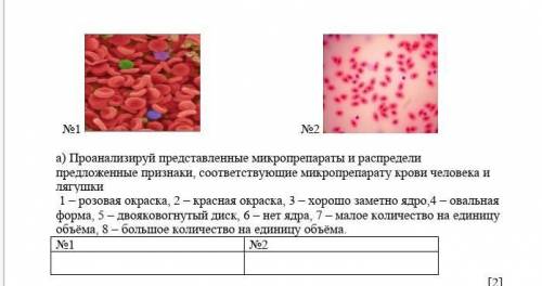 3. Представлены два микропрепарата крови человека И1 и лягушки И2​