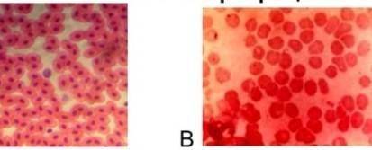 На рисунках А и В показаны эритроциты человека и лягушки. А В а) Определите, кому принадлежат данны