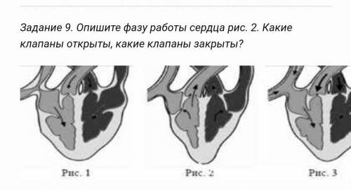 Опишите фазу работы сердца рис2. Какие клапаны открыты какие клапаны закрыты