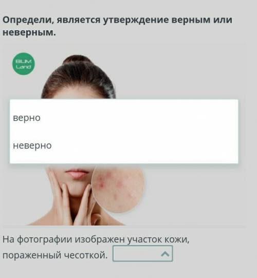 Определи, является утверждение верным или неверным. На фотографии изображен участок кожи, пораженны