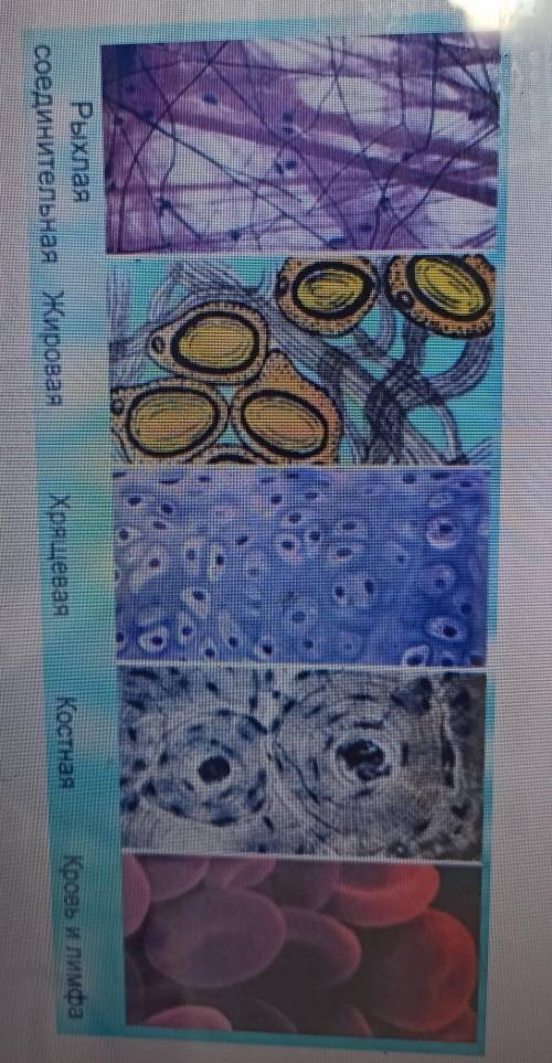 Из предложенных образцов ткани выберите рыхлую соединительную ткань, расскажите еë строение и функци