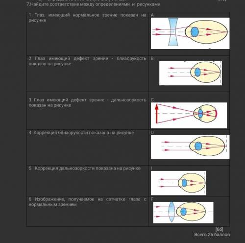 Найдите соответствие между определениями и рисунками 1 Глаз, имеющий нормальное зрение показан на ри