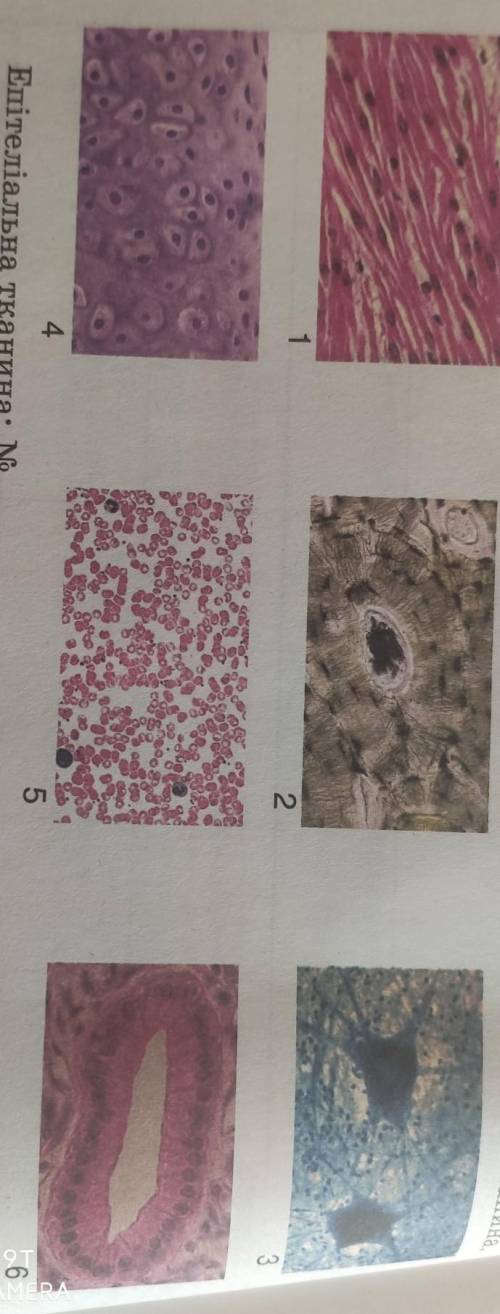 Крч ребят, задача для 1 класса, нужно точный ответ! Люблю вас, заранее !♥ надо найти эпителиальную т