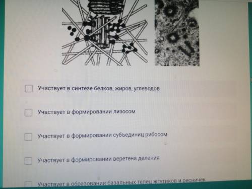 Выберите верные утверждения об изображеном на рисунке органоиде клетки