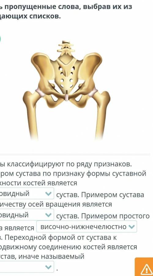 Суставы классифицируют по ряду признаков. Примером сустава по признаку формы суставной поверхности к